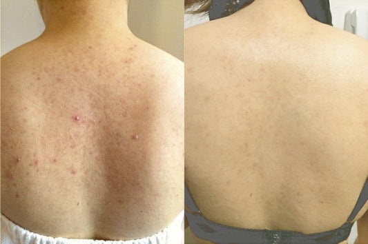 Spray de granos para el cuerpo