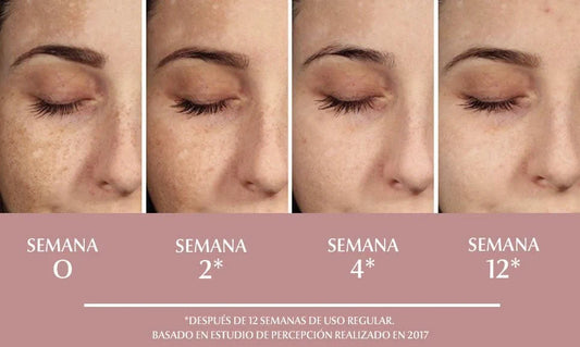 Crema Blanqueadora con Vitamina C 3Q Beauty 150ml – Ilumina, Unifica y Revitaliza la Piel con Poder Antioxidante